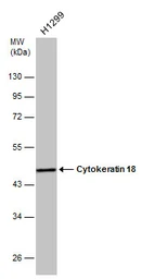 Anti-Cytokeratin 18 antibody [N1N3] used in Western Blot (WB). GTX112977