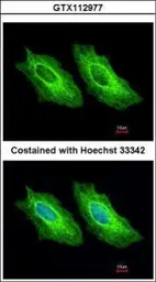 Anti-Cytokeratin 18 antibody [N1N3] used in Immunocytochemistry/ Immunofluorescence (ICC/IF). GTX112977