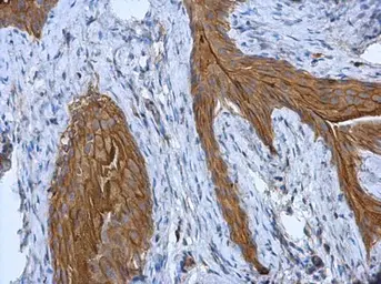 Anti-Cytokeratin 18 antibody [N3C3] used in IHC (Paraffin sections) (IHC-P). GTX112978