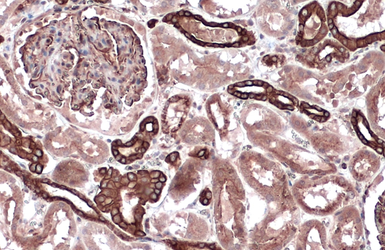 Anti-Cytokeratin 18 antibody [N3C3] used in IHC (Paraffin sections) (IHC-P). GTX112978