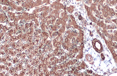 Anti-Cytokeratin 18 antibody [N3C3] used in IHC (Paraffin sections) (IHC-P). GTX112978