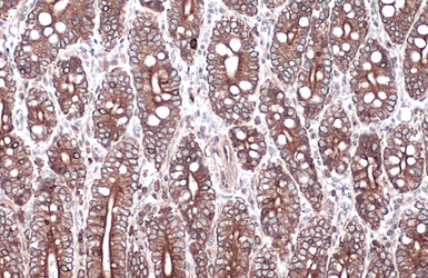 Anti-Cytokeratin 18 antibody [N3C3] used in IHC (Paraffin sections) (IHC-P). GTX112978