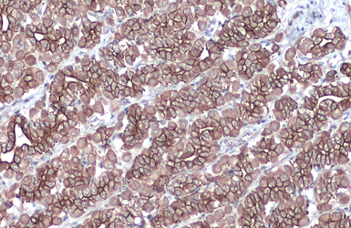 Anti-Cytokeratin 18 antibody [N3C3] used in IHC (Paraffin sections) (IHC-P). GTX112978