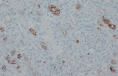 Anti-Cytokeratin 18 antibody [N3C3] used in IHC (Paraffin sections) (IHC-P). GTX112978