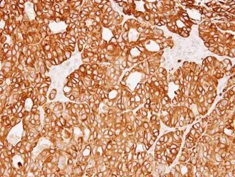 Anti-Cytokeratin 18 antibody [N3C3] used in IHC (Paraffin sections) (IHC-P). GTX112978