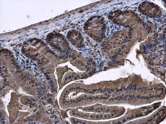 Anti-SMAD4 antibody used in IHC (Paraffin sections) (IHC-P). GTX112980