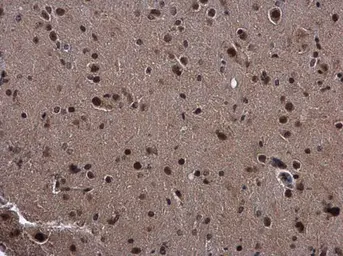 Anti-SMAD4 antibody used in IHC (Paraffin sections) (IHC-P). GTX112980