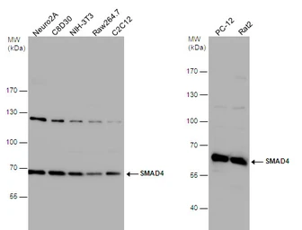 Anti-SMAD4 antibody used in Western Blot (WB). GTX112980