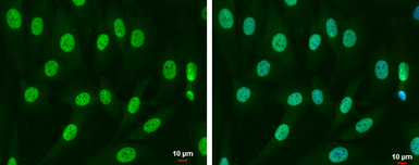 Anti-SMAD4 antibody used in Immunocytochemistry/ Immunofluorescence (ICC/IF). GTX112980
