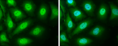 Anti-SMAD4 antibody used in Immunocytochemistry/ Immunofluorescence (ICC/IF). GTX112980