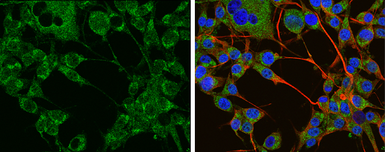 Anti-Tyrosine Hydroxylase antibody used in Immunocytochemistry/ Immunofluorescence (ICC/IF). GTX113016