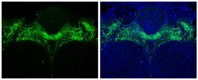 Anti-Tyrosine Hydroxylase antibody used in IHC (Paraffin sections) (IHC-P). GTX113016