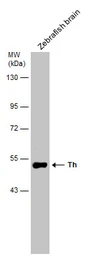 Anti-Tyrosine Hydroxylase antibody used in Western Blot (WB). GTX113016