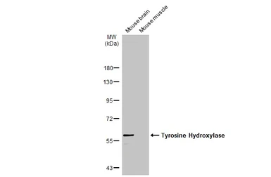 Anti-Tyrosine Hydroxylase antibody used in Western Blot (WB). GTX113016