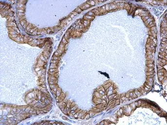 Anti-Cytokeratin 5 antibody used in IHC (Paraffin sections) (IHC-P). GTX113219