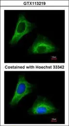 Anti-Cytokeratin 5 antibody used in Immunocytochemistry/ Immunofluorescence (ICC/IF). GTX113219