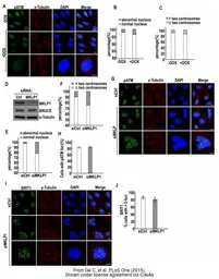 Anti-gamma Tubulin antibody used in Immunocytochemistry/ Immunofluorescence (ICC/IF). GTX113286