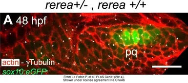 Anti-gamma Tubulin antibody used in IHC (Whole mount) (IHC-Wm). GTX113286