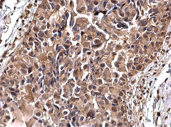 Anti-gamma Tubulin antibody used in IHC (Paraffin sections) (IHC-P). GTX113286