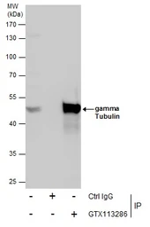 Anti-gamma Tubulin antibody used in Immunoprecipitation (IP). GTX113286