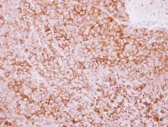 Anti-CD73 antibody [N1N3] used in IHC (Paraffin sections) (IHC-P). GTX113509