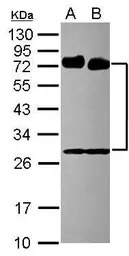 Anti-CD73 antibody [N1N3] used in Western Blot (WB). GTX113509