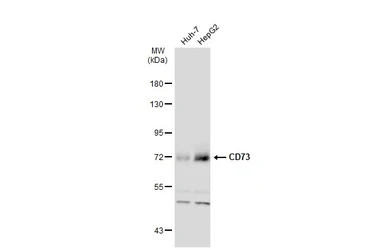 Anti-CD73 antibody [N1N3] used in Western Blot (WB). GTX113509