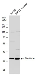 Anti-Fibrillarin antibody used in Western Blot (WB). GTX113684