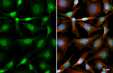Anti-Fibrillarin antibody used in Immunocytochemistry/ Immunofluorescence (ICC/IF). GTX113684