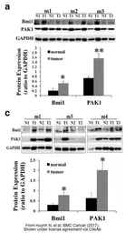 Anti-Bmi1 antibody used in Western Blot (WB). GTX114008