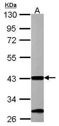Anti-ACAA1 antibody used in Western Blot (WB). GTX114229