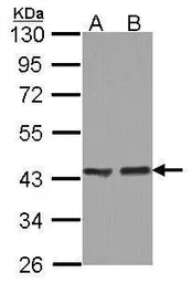 Anti-ACAA1 antibody used in Western Blot (WB). GTX114229