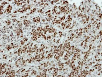 Anti-Brn2 antibody used in IHC (Paraffin sections) (IHC-P). GTX114650