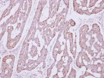 Anti-Occludin antibody used in IHC (Paraffin sections) (IHC-P). GTX114949