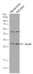 Anti-SCGN antibody [N2C3] used in Western Blot (WB). GTX115443