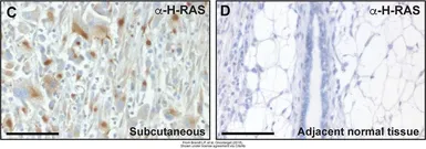 Anti-H-Ras antibody used in IHC (Paraffin sections) (IHC-P). GTX116041
