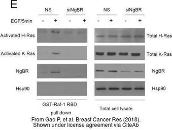Anti-H-Ras antibody used in Western Blot (WB). GTX116041