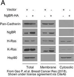 Anti-H-Ras antibody used in Western Blot (WB). GTX116041
