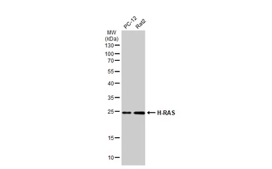 Anti-H-Ras antibody used in Western Blot (WB). GTX116041