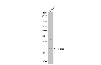 Anti-H-Ras antibody used in Western Blot (WB). GTX116041