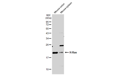 Anti-H-Ras antibody used in Western Blot (WB). GTX116041