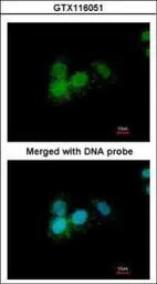 Anti-Progesterone Receptor antibody [N1], N-term used in Immunocytochemistry/ Immunofluorescence (ICC/IF). GTX116051