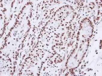 Anti-Progesterone Receptor antibody [N1], N-term used in IHC (Paraffin sections) (IHC-P). GTX116051