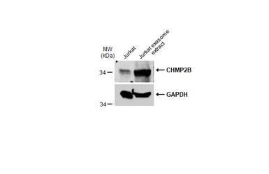 Anti-CHMP2B antibody used in Western Blot (WB). GTX118181