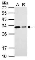 Anti-CHMP2B antibody used in Western Blot (WB). GTX118181