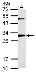 Anti-CHMP2B antibody used in Western Blot (WB). GTX118181