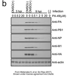 Anti-Influenza A virus PA protein antibody used in Western Blot (WB). GTX118991