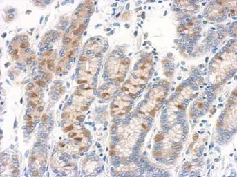 Anti-RAB11B antibody [N1C3] used in IHC (Paraffin sections) (IHC-P). GTX119095