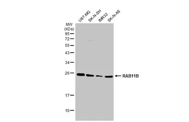 Anti-RAB11B antibody [N1C3] used in Western Blot (WB). GTX119095