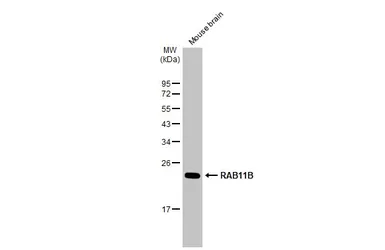 Anti-RAB11B antibody [N1C3] used in Western Blot (WB). GTX119095